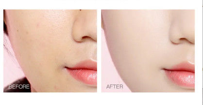 에틸 아스코르브산 피부 밝기 분말 피부 밝기 콜라겐 Cas 86404-04-8